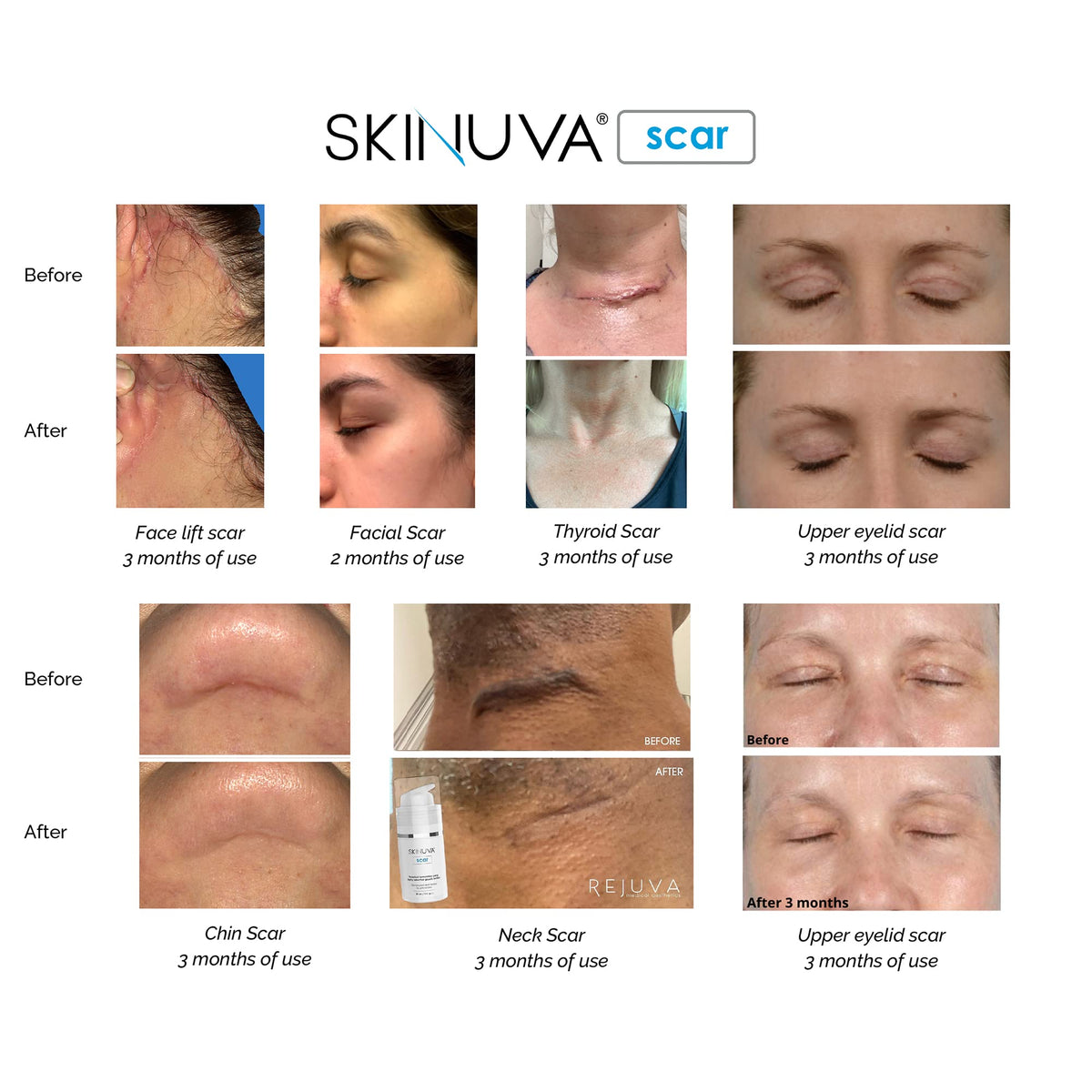 Skinuva used in postpartum setting showing gentle, pregnancy-safe care