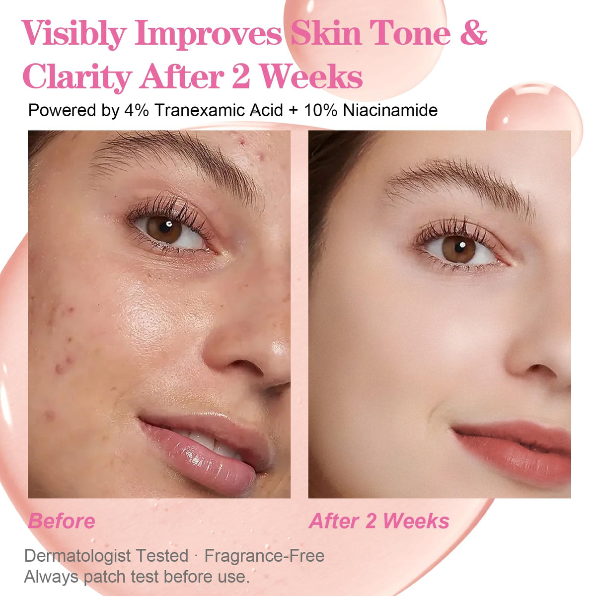 SKSOYT label close-up highlighting active concentrations and transparent ingredient benefit