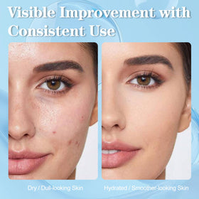 SKSOYT dropper pouring a clear serum illustrating smooth, non-greasy consistency
