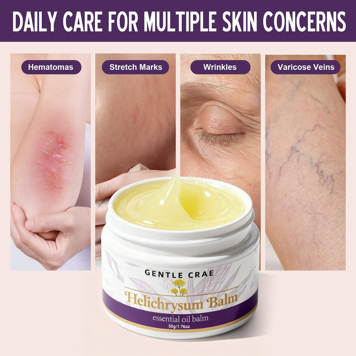 SKSOYT balm used on lips and cuticles to hydrate and protect delicate areas