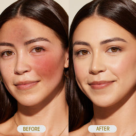 SKSOYT neck and décolletage usage illustrating gentle hydration benefit