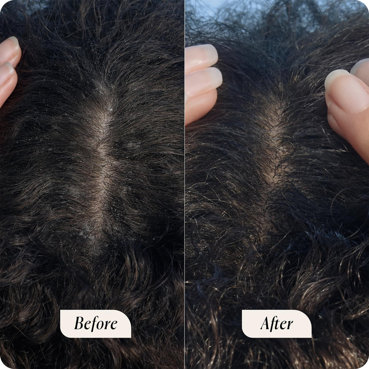 Sky Organics being massaged into scalp, soothes dryness and itch