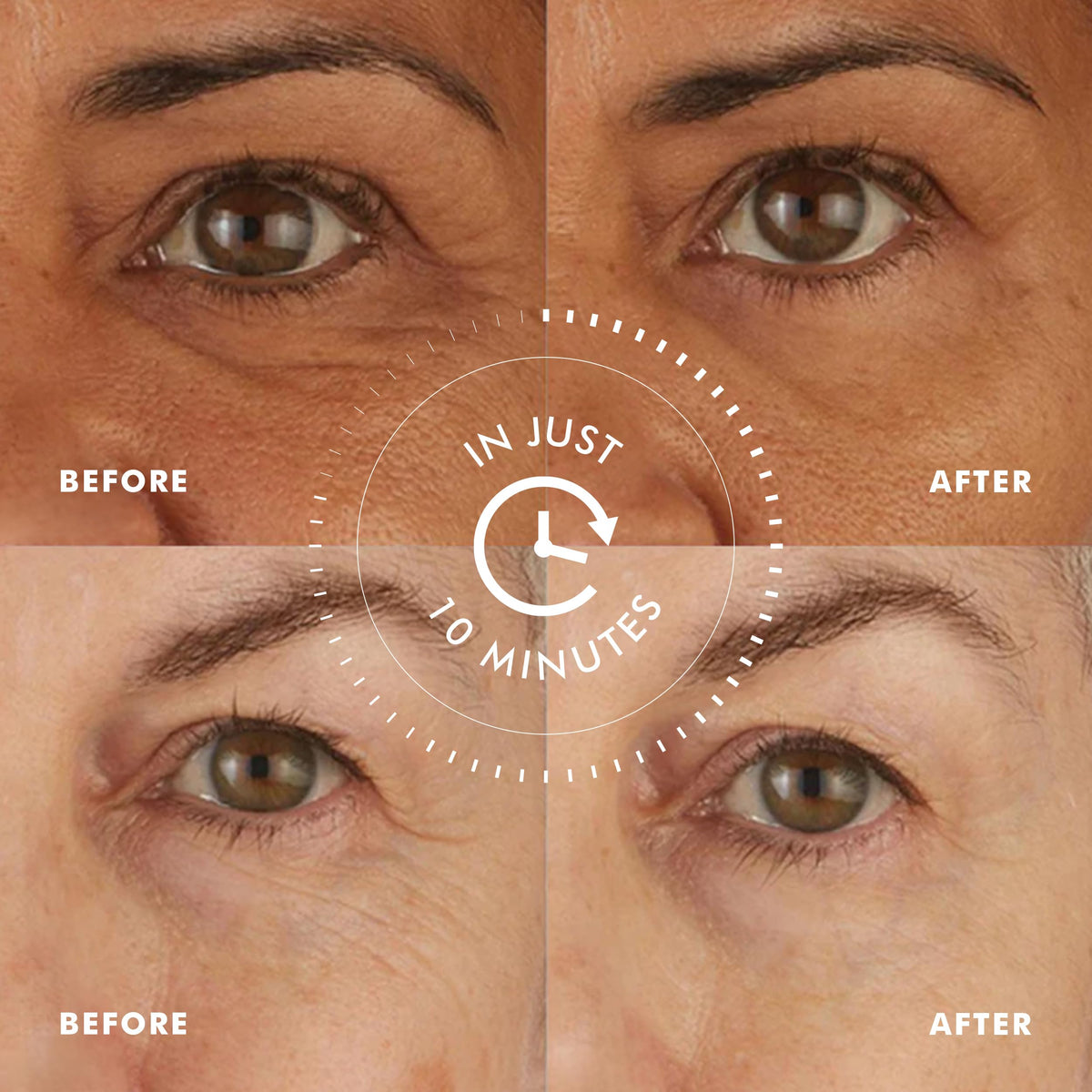 skyn ICELAND patches applied under eye illustrating instant cooling