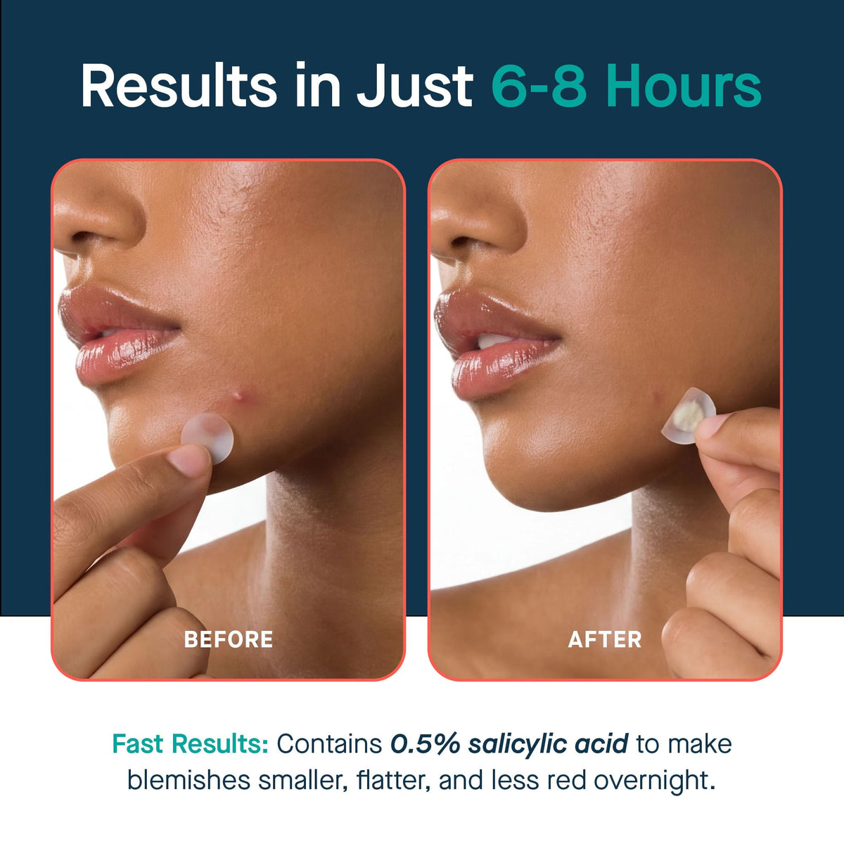 SLMD patch applied to cheek demonstrating discreet wear and protection