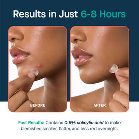 SLMD patch applied to cheek demonstrating discreet wear and protection