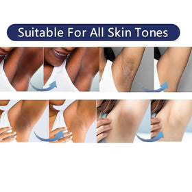 SMILEFACE being applied to underarm area demonstrating targeted brightening