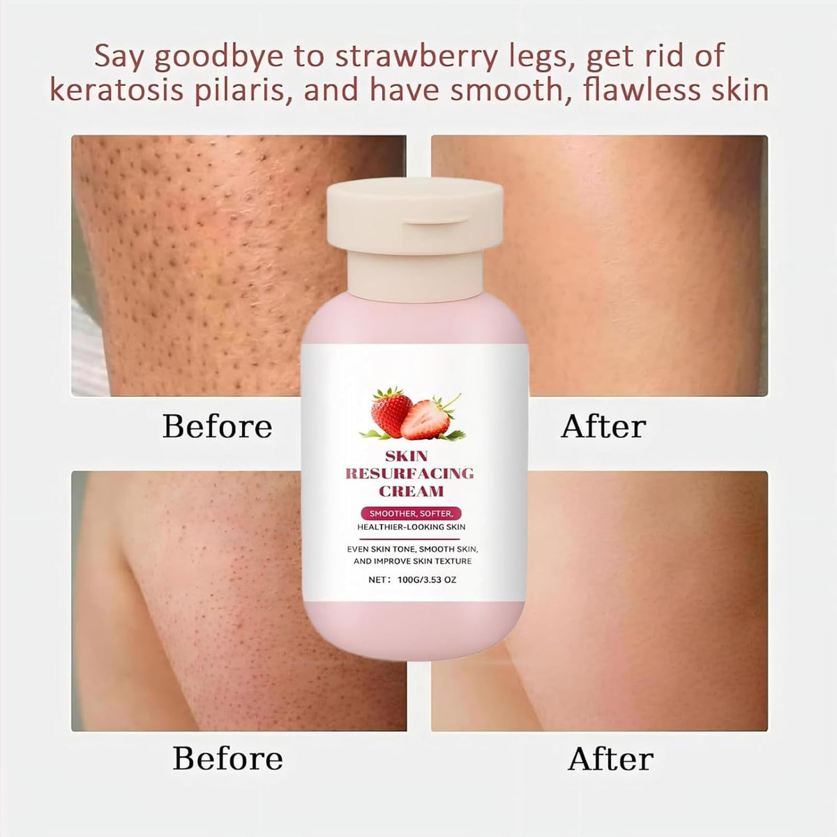 Soelegant applying cream to leg demonstrating smoothing effect and improved texture