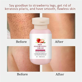 Soelegant applying cream to leg demonstrating smoothing effect and improved texture