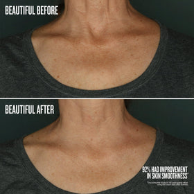 Sol de Janeiro plant squalane visual emphasizing immediate plumping benefit