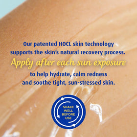 Solarcaine being applied to hand demonstrating quick soothing relief