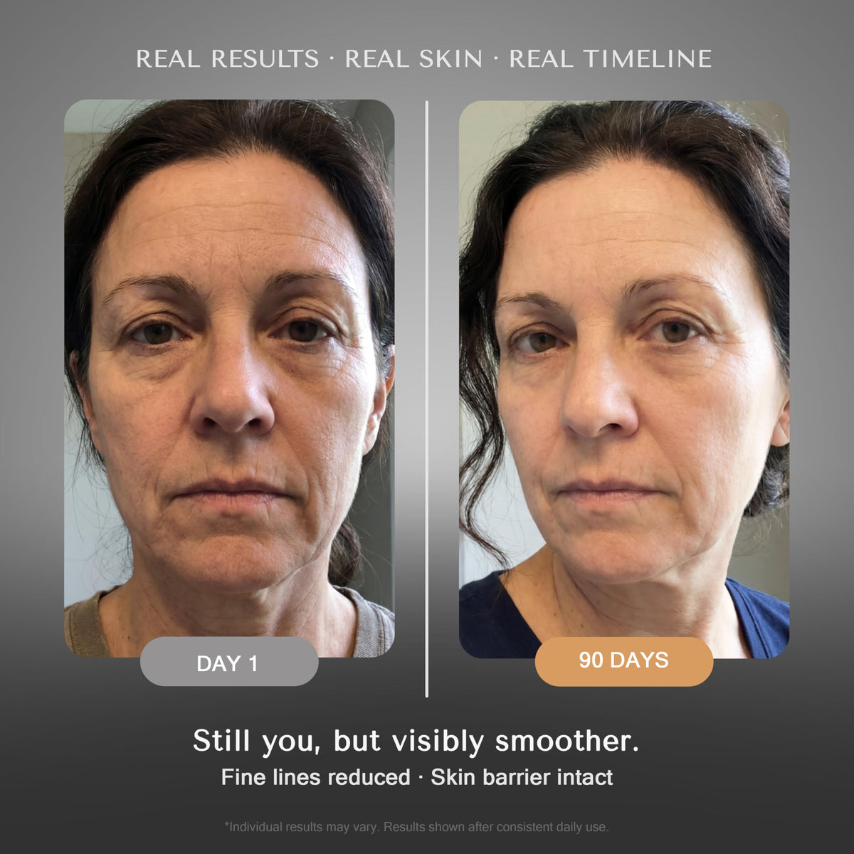 SOLURETINOL night serum texture on fingertip showing rich hydration benefit for overnight use