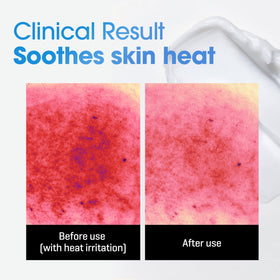 SOME BY MI cream being dispensed onto hand demonstrating easy application