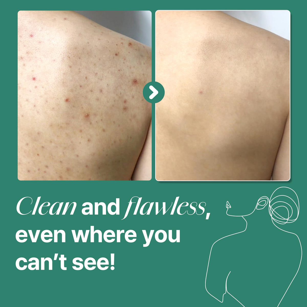 SOME BY MI in-shower use demonstrating effective cleansing of back and chest