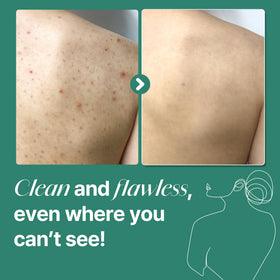SOME BY MI in-shower use demonstrating effective cleansing of back and chest