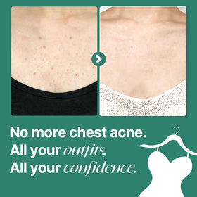 SOME BY MI label close-up listing AHA BHA PHA ingredients and benefits