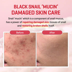 SOME BY MI label ingredient list highlighting snail mucin benefits
