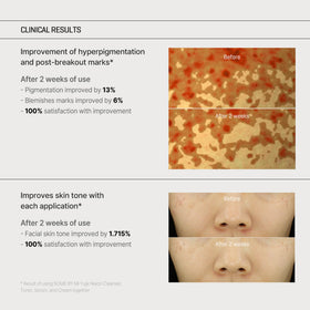 SOME BY MI label close-up showing ingredient highlights for transparency