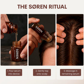 SØREN sealed 5ml serum vials close-up showing ingredient blend