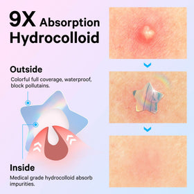 Sosky close-up of hydrocolloid texture illustrating secure adhesion and barrier