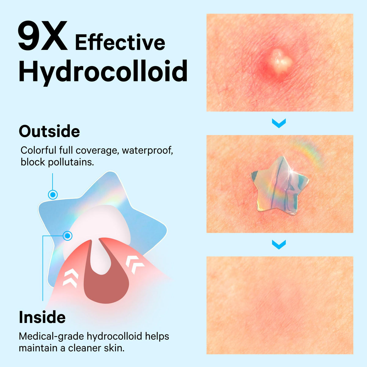 Sosky macro view of hydrocolloid texture highlighting protective absorbent surface