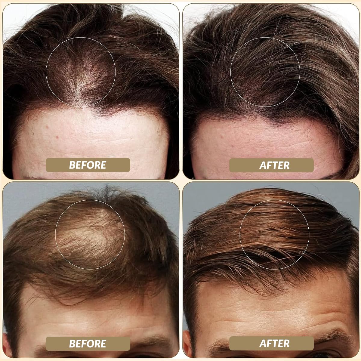 SOVONCARE application demo on thinning spot illustrating quick coverage benefit