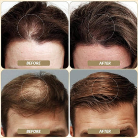 SOVONCARE application demo on thinning spot illustrating quick coverage benefit