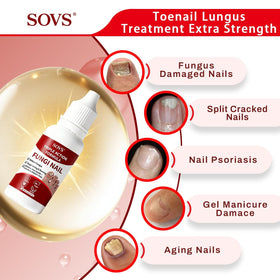 SOVS being applied to a toenail demonstrating easy daily cosmetic care