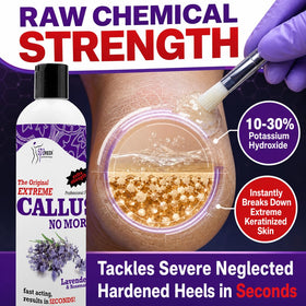 SPA REDI application by technician highlighting targeted callus removal and speed benefits