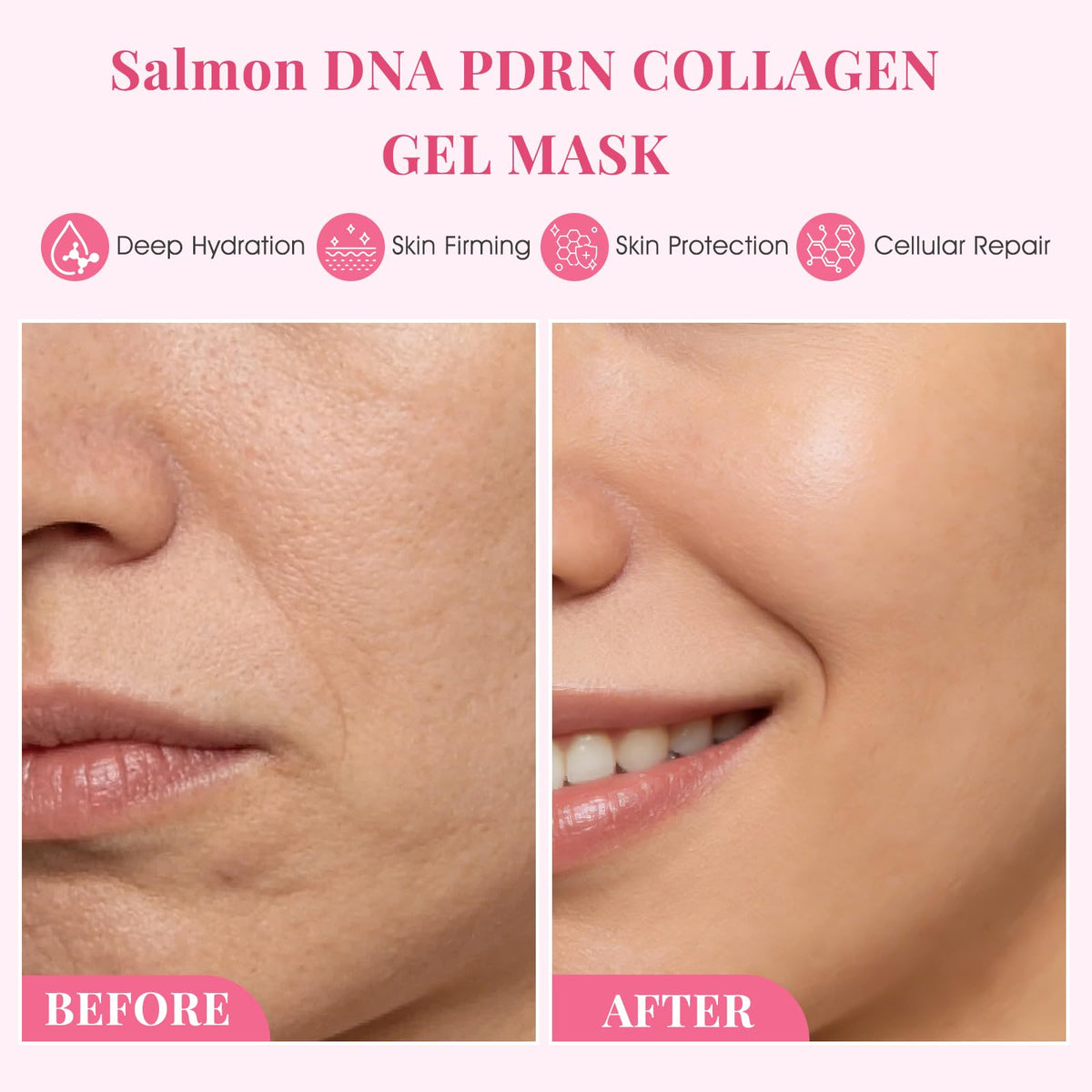 Model wearing SPRINGSKY gel mask overnight for intense hydration