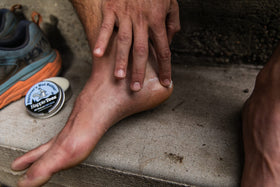 Squirrel's Nut Butter applied to heel to prevent blisters and soothe skin
