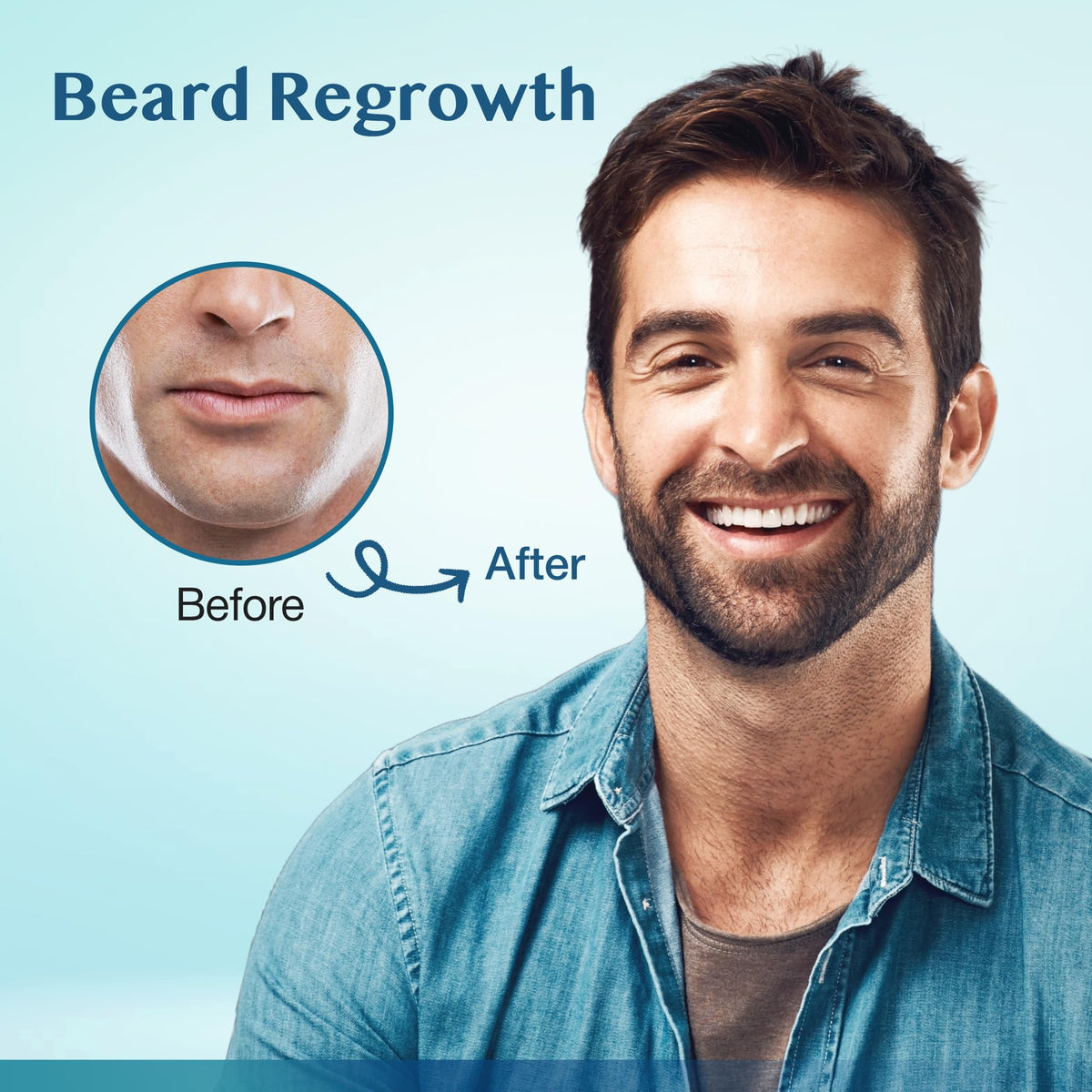Man applying Stafenit to beard area demonstrating targeted use and improved coverage