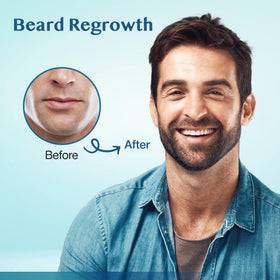 Man applying Stafenit to beard area demonstrating targeted use and improved coverage