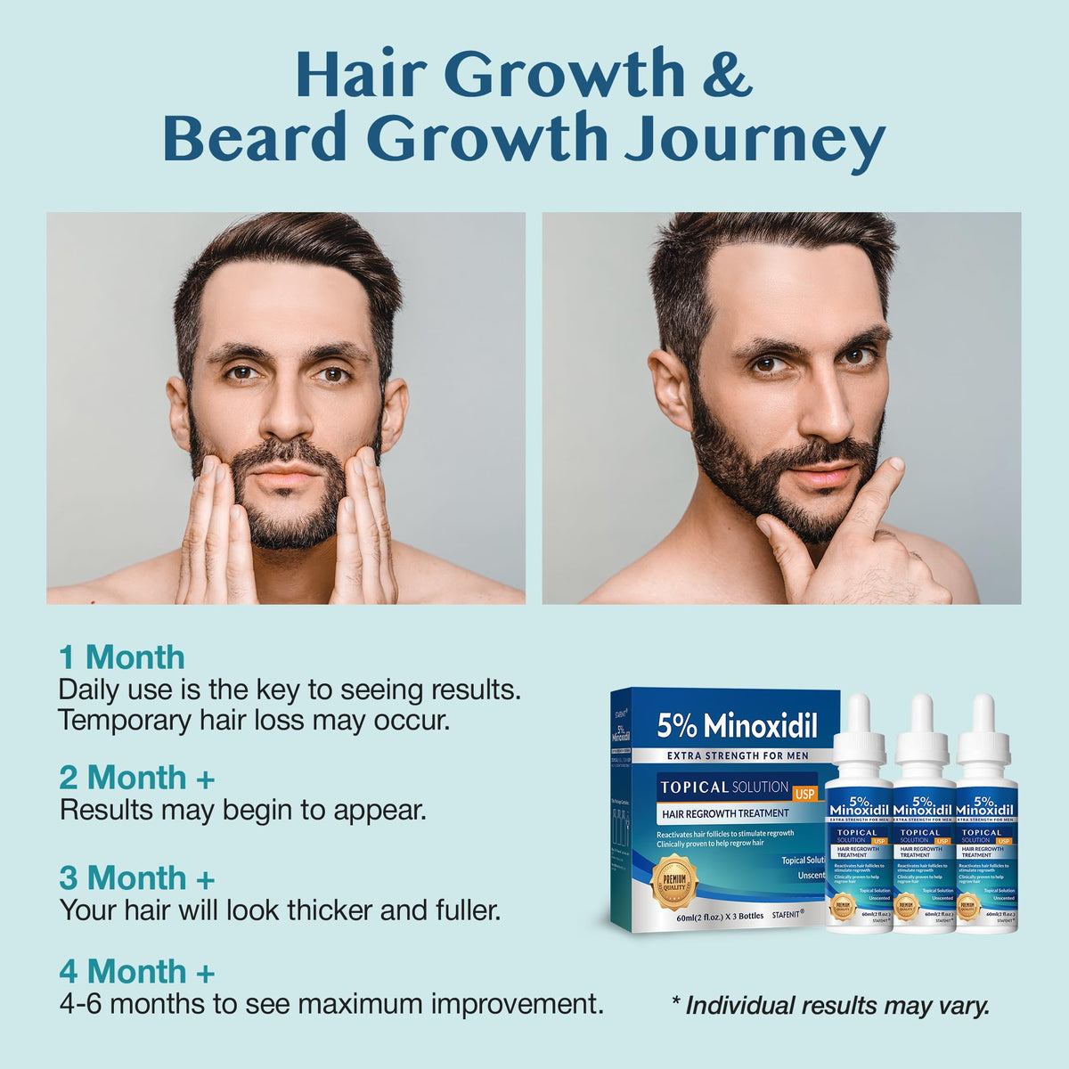 Topical application of Stafenit on scalp showing accurate placement for thinning areas