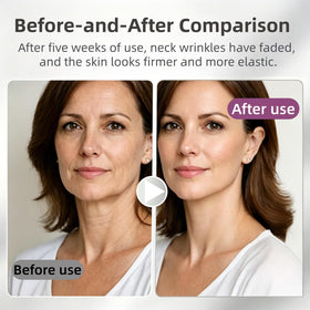 STDKDFW model applying cream to neck with roller for firmer-looking contours