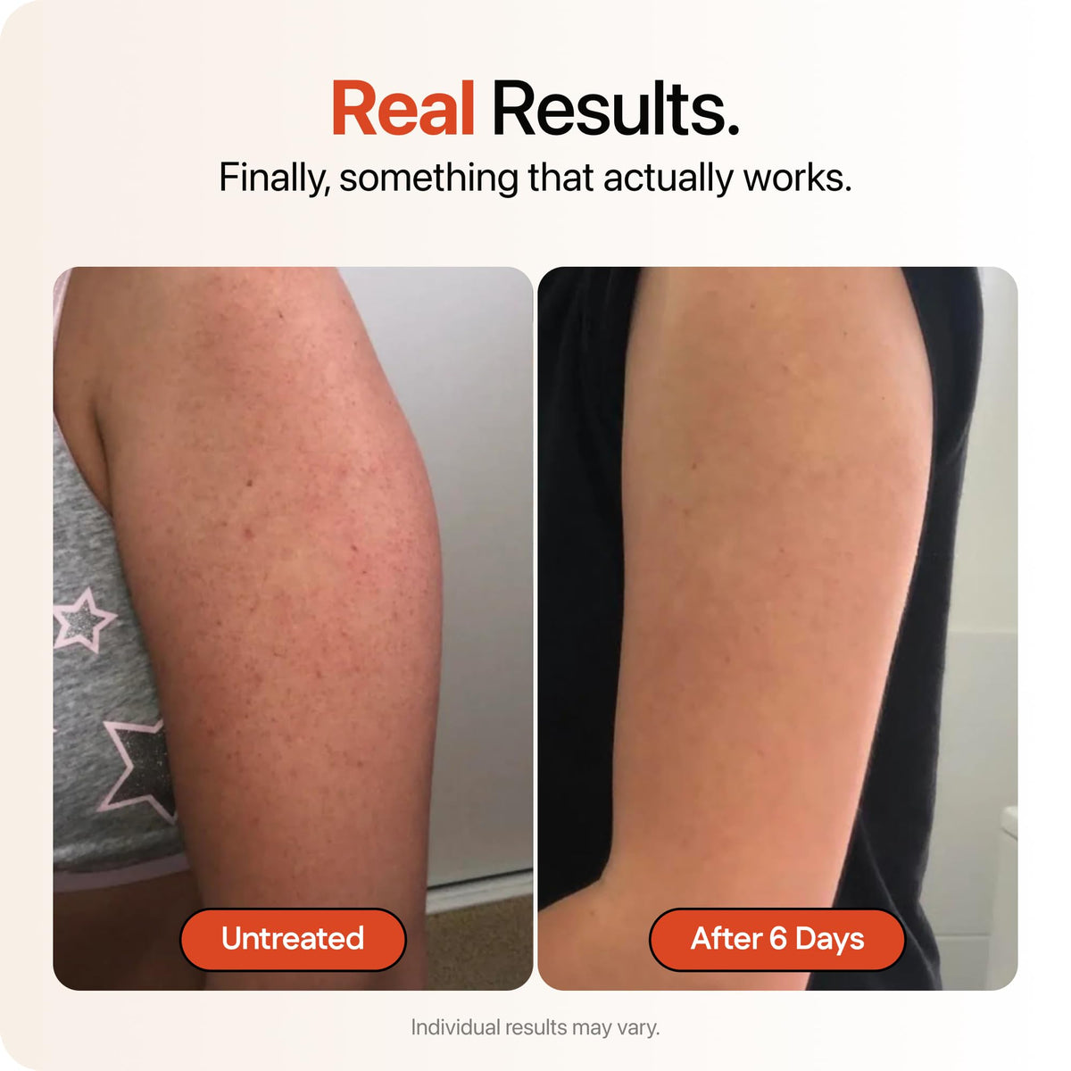 Strawberry back label with active acids and hydrating ingredients listed