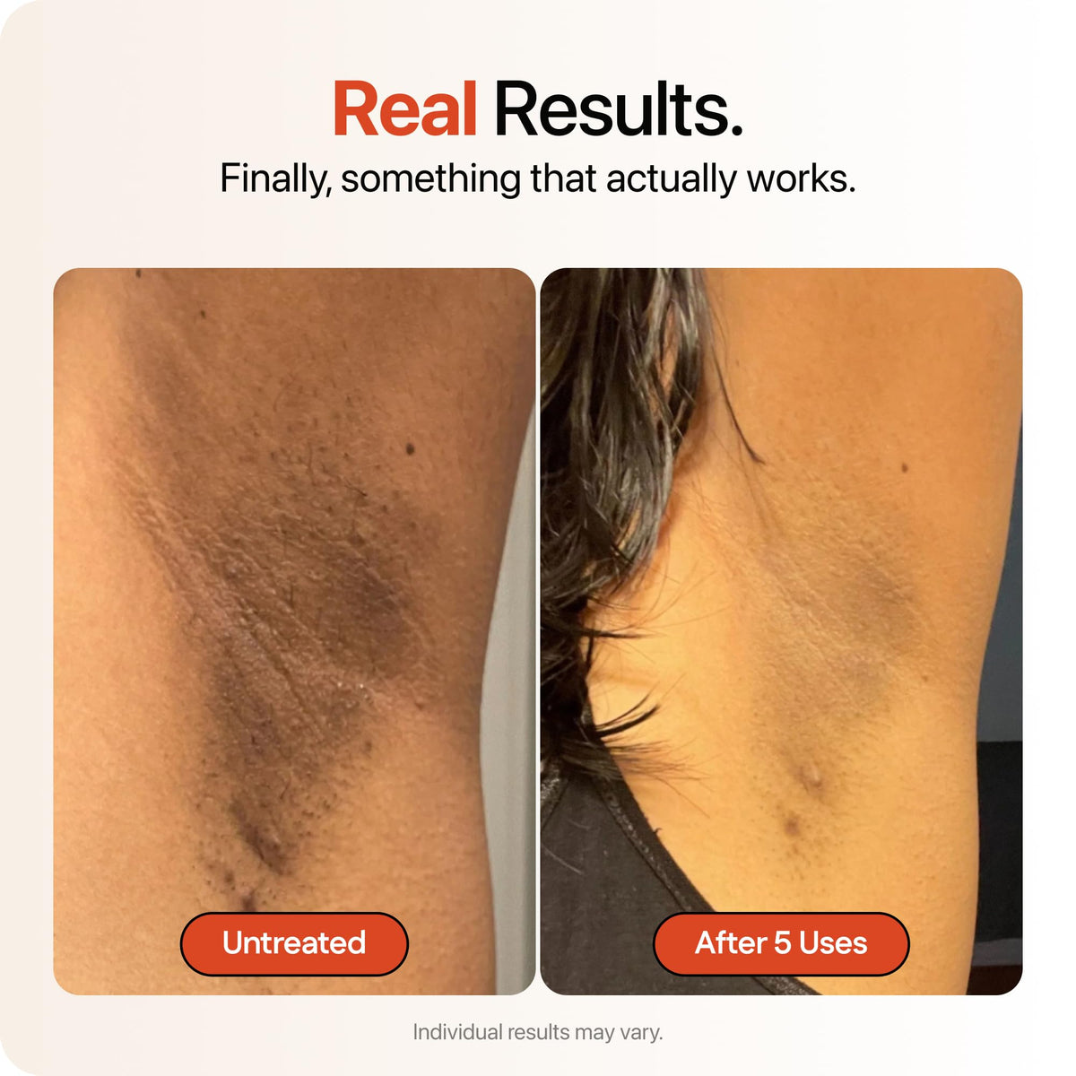 Strawberry face spot treatment showing precise application and even-tone benefit