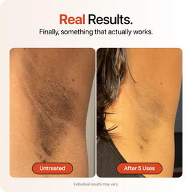 Strawberry face spot treatment showing precise application and even-tone benefit
