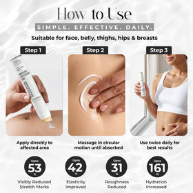 StretchMarkers 1 fl oz bottle beside common items for size reference