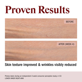 STRIPES open jar revealing rich buttery cream that comforts dry skin