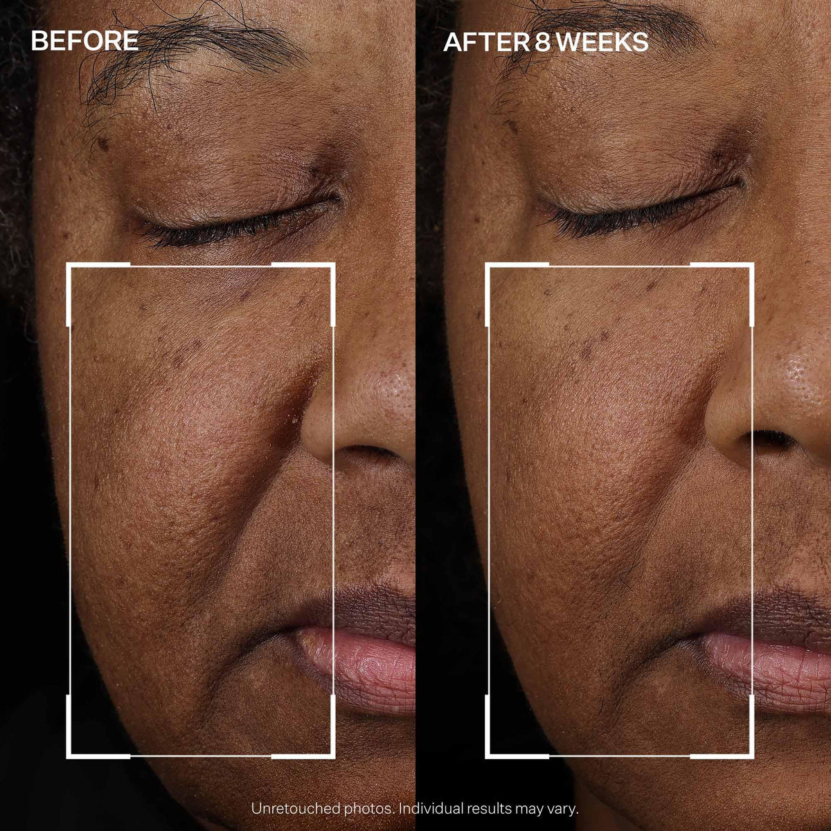 StriVectin illustrative before and after visual showing improved tone and lift benefit