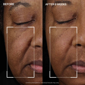 StriVectin illustrative before and after visual showing improved tone and lift benefit