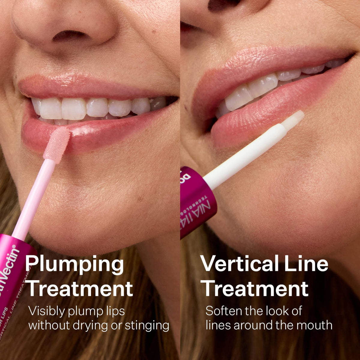 StriVectin before and after comparison showing reduced vertical lines