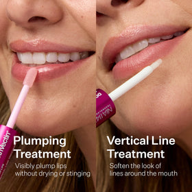 StriVectin before and after comparison showing reduced vertical lines
