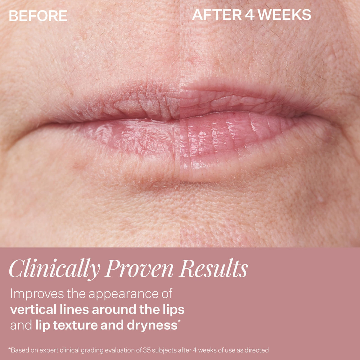 StriVectin size and cap detail highlighting travel-friendly design