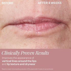 StriVectin size and cap detail highlighting travel-friendly design