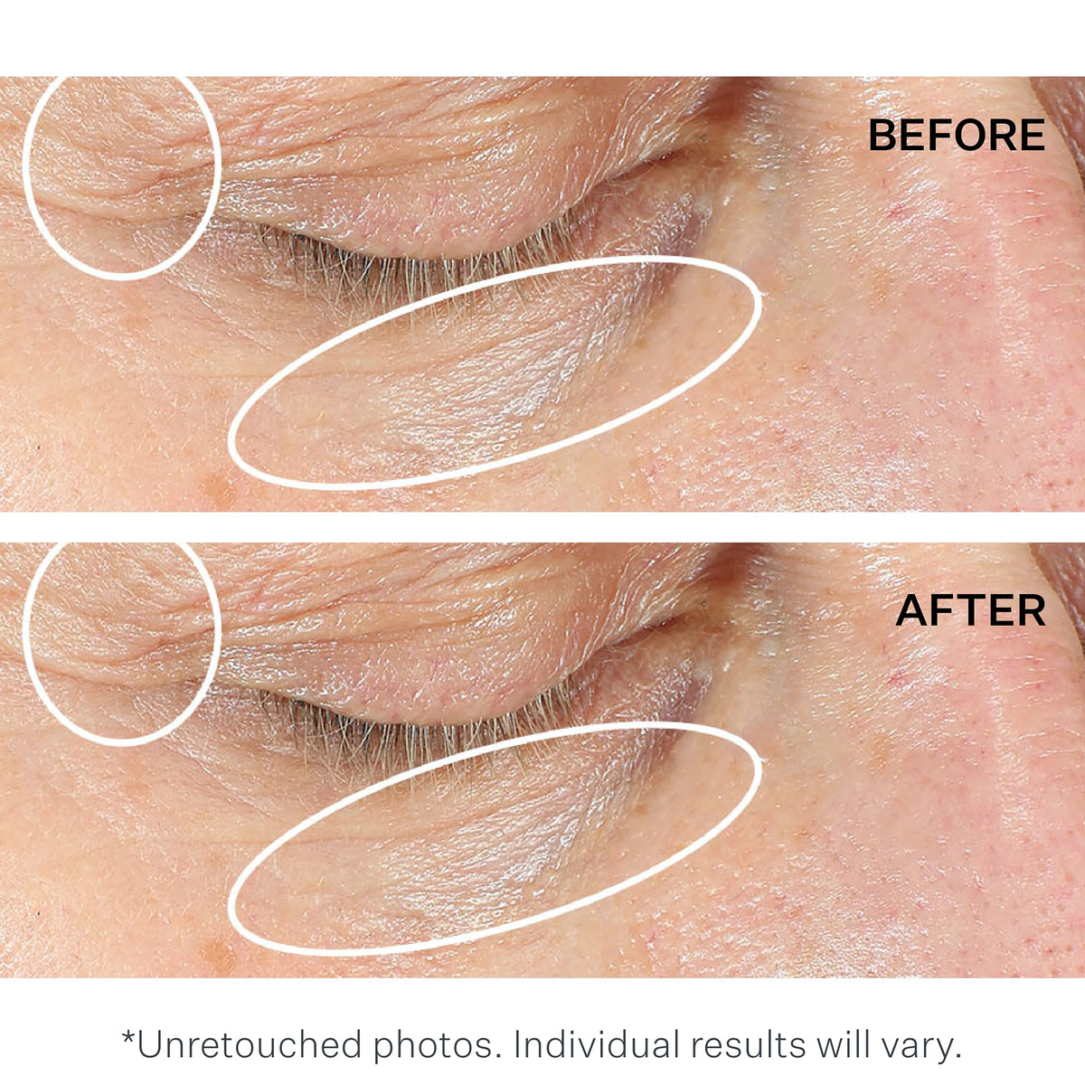 StriVectin product dabbed on hand demonstrating smooth blendability and layering
