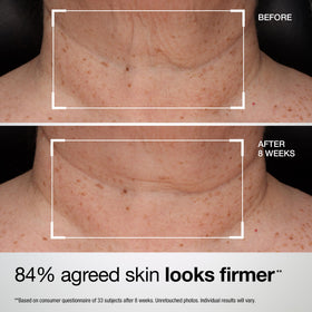 StriVectin neck application demo illustrating even coverage and quick absorption