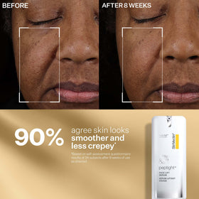 StriVectin neck cream tube open showing cream consistency and firming benefit