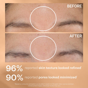 Before-and-after cheek using StriVectin pad showing smoother skin benefit