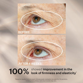 StriVectin ingredient layout highlighting peptides and antioxidants for visible firming
